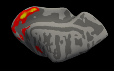 Prometedor modelo para restaurar función de los conos con IRMf