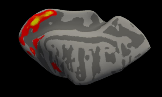 Prometedor modelo para restaurar función de los conos con IRMf