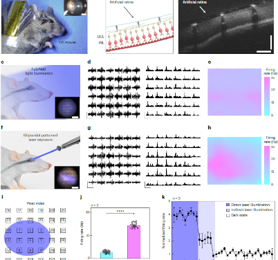 Avances en restauración visual: Proyecto de prótesis retiniana con microelectrodos de metal líquido