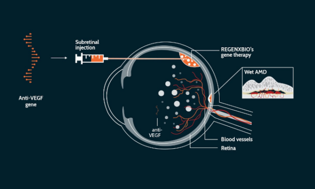 Estudio de fase 1/2a que evalúa ABBV-RGX-314 como terapia génica única para DMAE húmeda