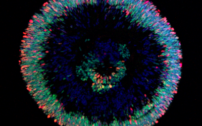 Imagen del Mes: Organoides retinianos humanos