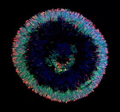 Imagen del Mes: Organoides retinianos humanos