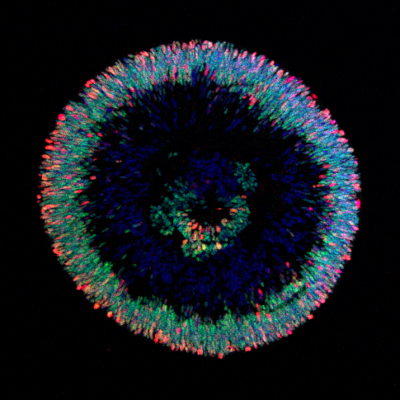 Imagen del Mes: Organoides retinianos humanos