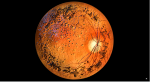 ViGeneron inicia ensayo clínico para tratar la retinosis pigmentaria con dosis inicial de VG901 para CNGA1