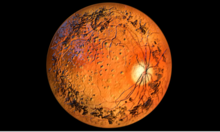 ViGeneron inicia ensayo clínico para tratar la retinosis pigmentaria con dosis inicial de VG901 para CNGA1