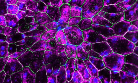 Aumentar la proteína IRAK-M en las células de la retina podría prevenir la pérdida de visión en la DMAE