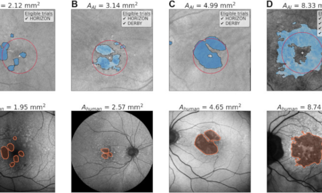 Inteligencia Artificial para optimizar el reclutamiento en Ensayos Clínicos sobre Degeneración Macular Relacionada con la Edad (DMAE)