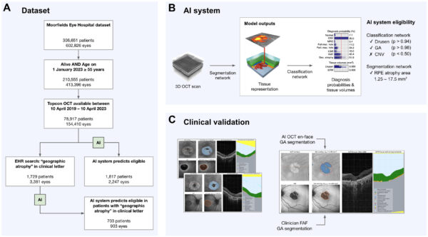 Figura 3. Descripción general del conjunto de datos, el sistema de IA y la validación clínica. A. De un gran conjunto de datos del Moorfields Eye Hospital de 306.651 pacientes, 78.917 cumplían los criterios de inclusión de nuestra cohorte. La búsqueda en la HCE y el sistema de IA se aplicaron por separado a esta cohorte para identificar una lista de posibles participantes. El sistema de IA se aplicó posteriormente a los pacientes preseleccionados por la búsqueda de HCE para funcionar como un enfoque combinado de IA-HCE. B. Las exploraciones OCT de volumen completo se introducen en la red de segmentación profunda, que genera mapas de segmentación de 15 características anatómicas y patológicas, incluida la capa del epitelio pigmentario de la retina (EPR). A continuación, la red de clasificación profunda utiliza estos mapas de segmentación para predecir las probabilidades de diagnóstico de 10 patologías maculares concomitantes, incluidas drusas, AG y NVC. C. Para estimar el valor predictivo positivo de la lista reducida de participantes producida, se clasificó manualmente un subconjunto utilizando imágenes de OCT y FAF; estas últimas se segmentaron manualmente si había GA. A continuación, se compararon con los resultados de la búsqueda en la HCE y el sistema de IA basado en OCT.Traducción realizada con la versión gratuita del traductor www.DeepL.com/Translator