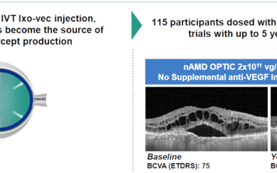 La terapia génica Ixo-vec reduce el número de inyecciones anti-VEGF en pacientes con DMAE neovascular