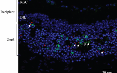 Nuevos enfoques para tratar enfermedades hereditarias de la retina