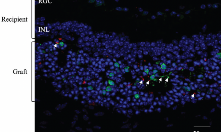 Nuevos enfoques para tratar enfermedades hereditarias de la retina
