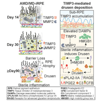 Posibles terapias para DMAE y distrofias maculares