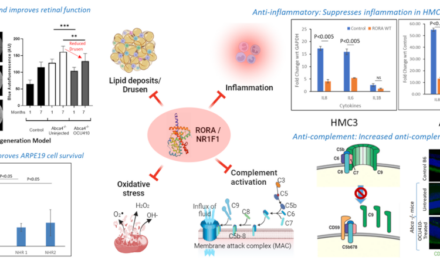 Avances en terapia génica con OCU410 para la atrofia geográfica (DMAE seca avanzada)