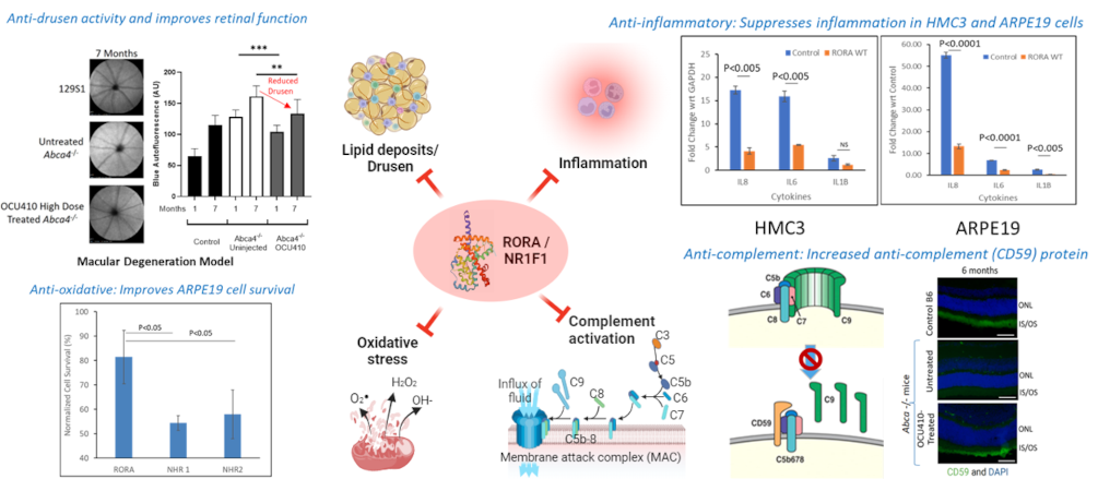 Avances en terapia génica con OCU410 para la atrofia geográfica (DMAE seca avanzada)