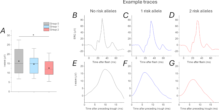 La onda i se vincula con una variante genética asociada al riesgo de miopía