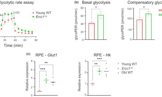 ERCC1-XPF: el deterioro genético factor clave en la degeneración macular asociada a la edad (DMAE)
