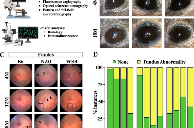El impacto de los genes en el envejecimiento de la retina y su conexión con la salud cerebral