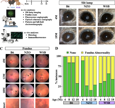El impacto de los genes en el envejecimiento de la retina y su conexión con la salud cerebral