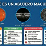 Avances en China en nueva técnica esperanzadora para cerrar agujeros maculares grandes