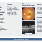 Honeycomb, la distrofia ultrarrara que asemeja un panal de abeja 