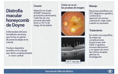 Honeycomb, la distrofia ultrarrara que asemeja un panal de abeja 