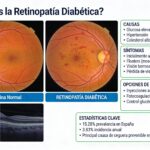 Un ensayo español prueba un colirio para frenar la retinopatía diabética 
